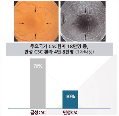 루트로닉_1.jpg