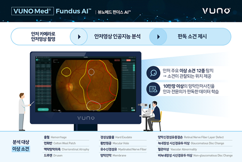 뷰노메드 펀더스 AI 제품 참고 이미지.png